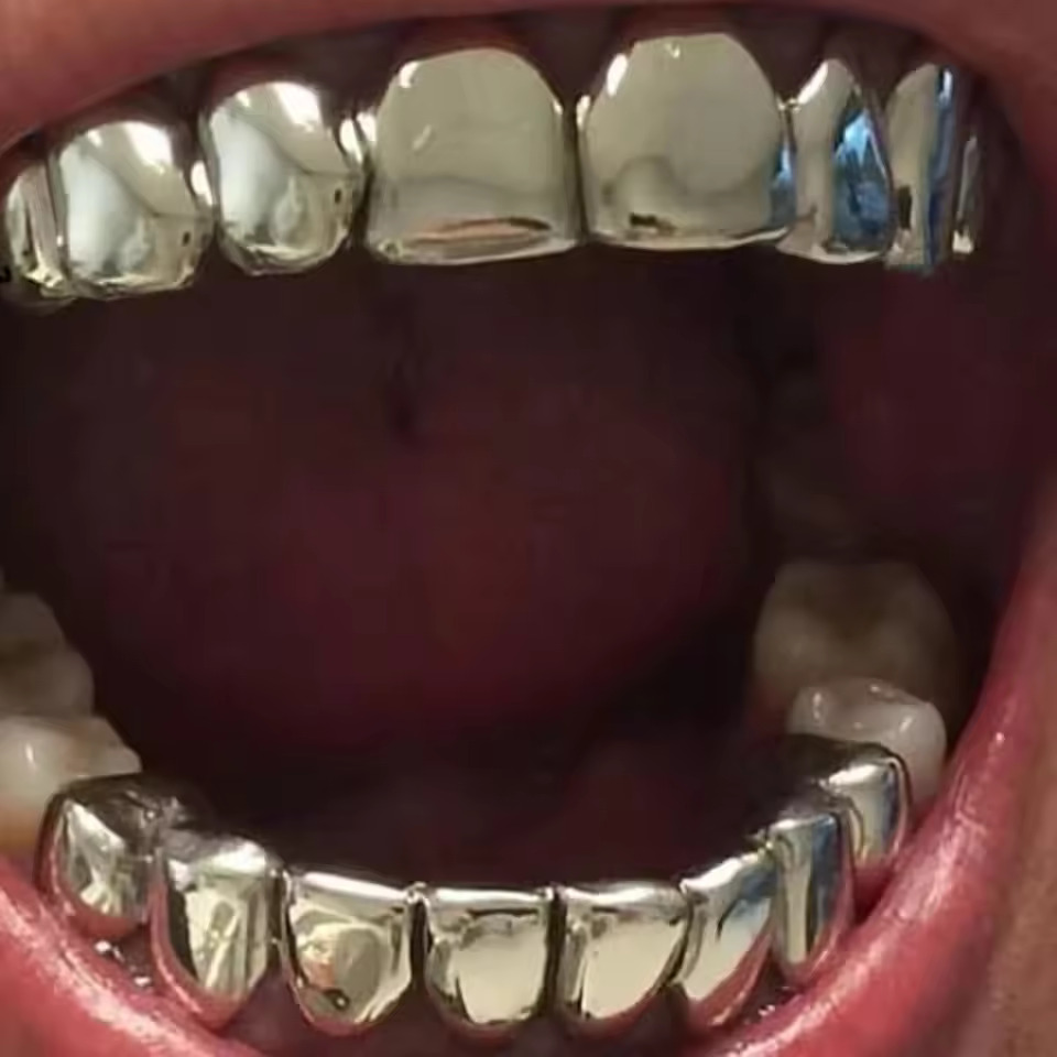 TOPGRILLZ Set di griglie super - Body Jewelry Real Gold recensione e prezzo